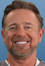 Kevin Millar